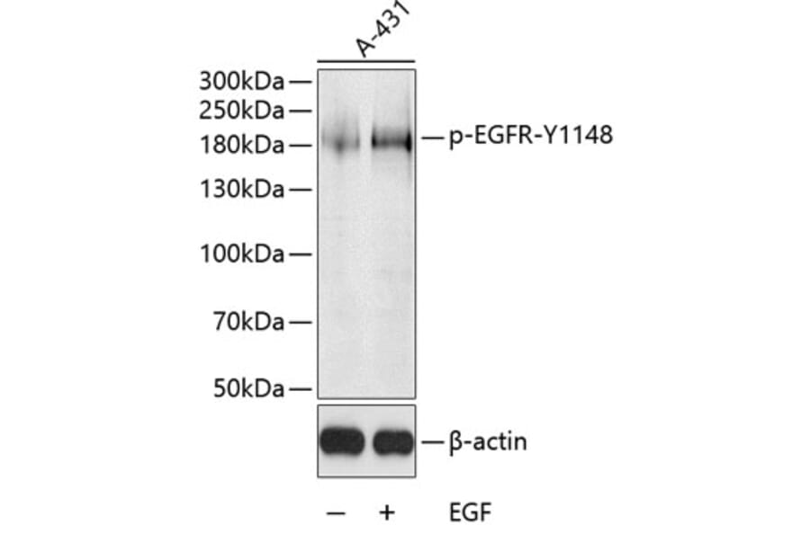 Western Blot - Anti-EGFR (phospho Tyr1148) Antibody (A10875) - Antibodies.com