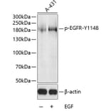 Western Blot - Anti-EGFR (phospho Tyr1148) Antibody (A10875) - Antibodies.com