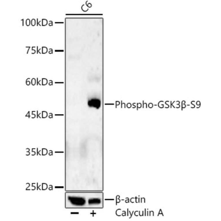 Western Blot - Anti-GSK3 beta (phospho Ser9) Antibody (A10877) - Antibodies.com