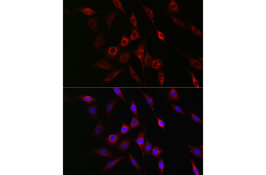 Immunofluorescence - Anti-GSK3 beta (phospho Ser9) Antibody (A10877) - Antibodies.com