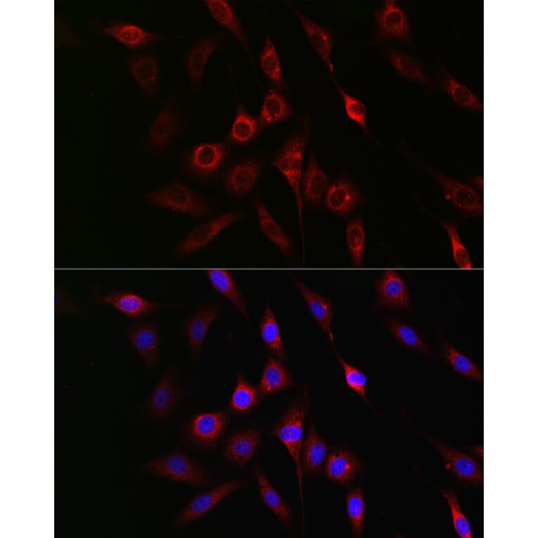 Immunofluorescence - Anti-GSK3 beta (phospho Ser9) Antibody (A10877) - Antibodies.com