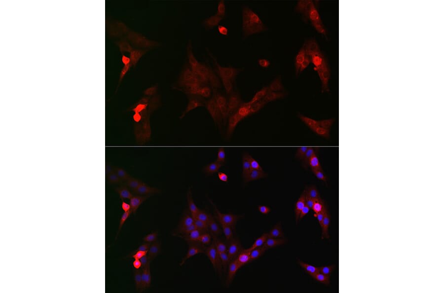 Immunofluorescence - Anti-GSK3 beta (phospho Ser9) Antibody (A10877) - Antibodies.com