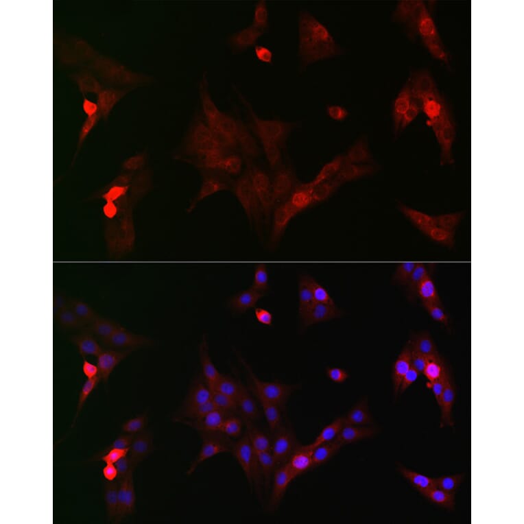 Immunofluorescence - Anti-GSK3 beta (phospho Ser9) Antibody (A10877) - Antibodies.com