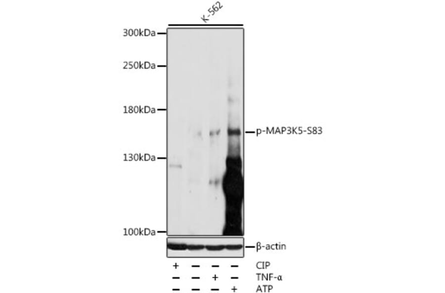 Western Blot - Anti-ASK1 (phospho Ser83) Antibody (A10879) - Antibodies.com