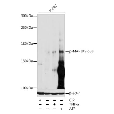 Western Blot - Anti-ASK1 (phospho Ser83) Antibody (A10879) - Antibodies.com