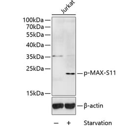Western Blot - Anti-MAX (phospho Ser11) Antibody (A10880) - Antibodies.com