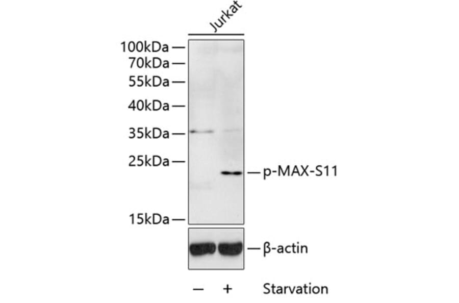 Western Blot - Anti-MAX (phospho Ser11) Antibody (A10880) - Antibodies.com