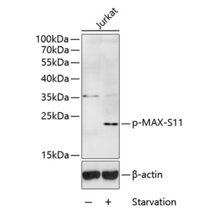 Western Blot - Anti-MAX (phospho Ser11) Antibody (A10880) - Antibodies.com