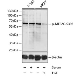 Western Blot - Anti-MEF2C (phospho Ser396) Antibody (A10882) - Antibodies.com