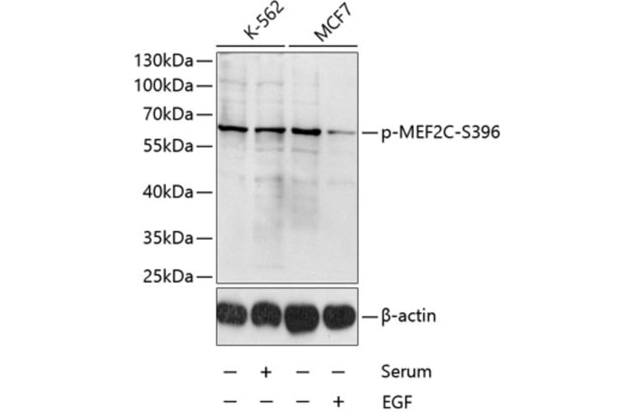 Western Blot - Anti-MEF2C (phospho Ser396) Antibody (A10882) - Antibodies.com