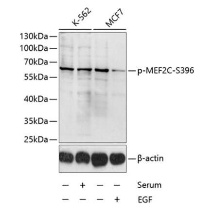 Western Blot - Anti-MEF2C (phospho Ser396) Antibody (A10882) - Antibodies.com