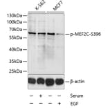 Western Blot - Anti-MEF2C (phospho Ser396) Antibody (A10882) - Antibodies.com