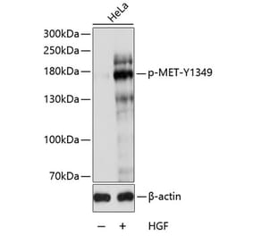 Western Blot - Anti-Met (c-Met) (phospho Tyr1349) Antibody (A10883) - Antibodies.com