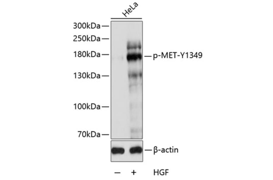 Western Blot - Anti-Met (c-Met) (phospho Tyr1349) Antibody (A10883) - Antibodies.com