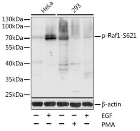 Western Blot - Anti-Raf1 (phospho Ser621) Antibody (A10884) - Antibodies.com
