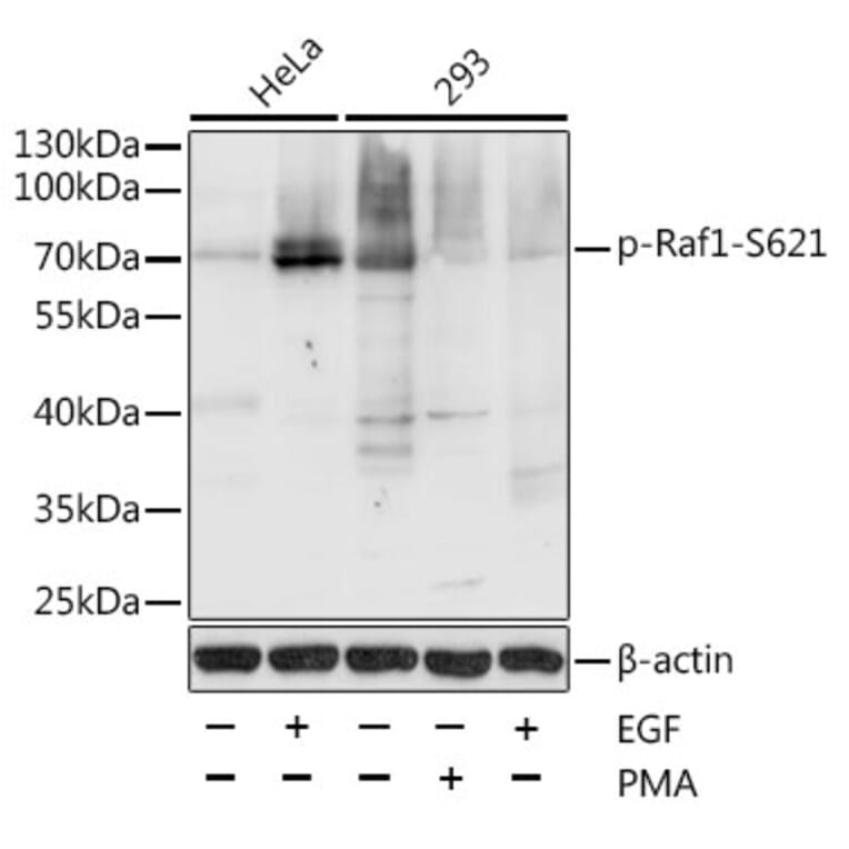 Western Blot - Anti-Raf1 (phospho Ser621) Antibody (A10884) - Antibodies.com