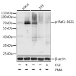Western Blot - Anti-Raf1 (phospho Ser621) Antibody (A10884) - Antibodies.com