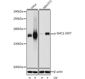 Western Blot - Anti-SMC1A (phospho Ser957) Antibody (A10885) - Antibodies.com