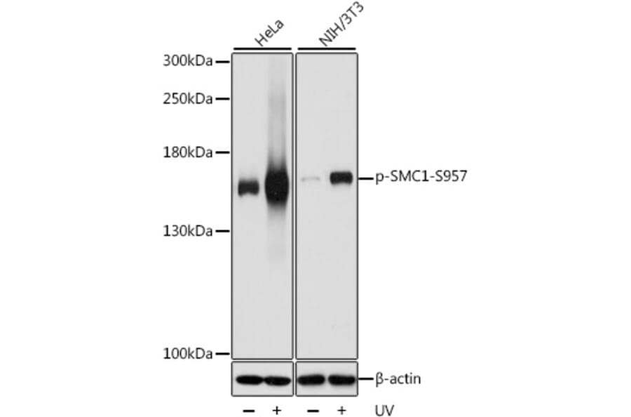 Western Blot - Anti-SMC1A (phospho Ser957) Antibody (A10885) - Antibodies.com