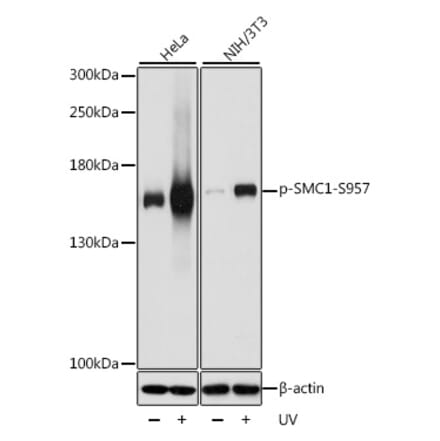 Western Blot - Anti-SMC1A (phospho Ser957) Antibody (A10885) - Antibodies.com