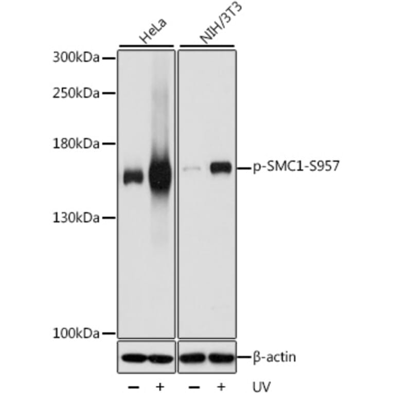 Western Blot - Anti-SMC1A (phospho Ser957) Antibody (A10885) - Antibodies.com