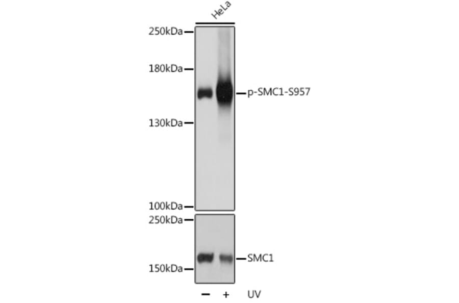Western Blot - Anti-SMC1A (phospho Ser957) Antibody (A10885) - Antibodies.com
