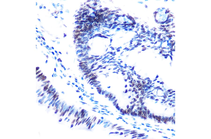 Immunohistochemistry - Anti-SMC1A (phospho Ser957) Antibody (A10885) - Antibodies.com