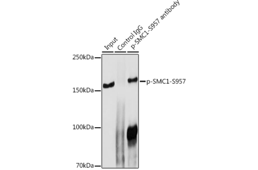 Western Blot - Anti-SMC1A (phospho Ser957) Antibody (A10885) - Antibodies.com
