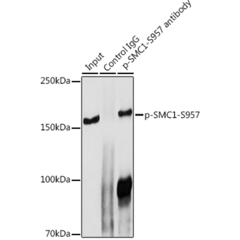 Western Blot - Anti-SMC1A (phospho Ser957) Antibody (A10885) - Antibodies.com