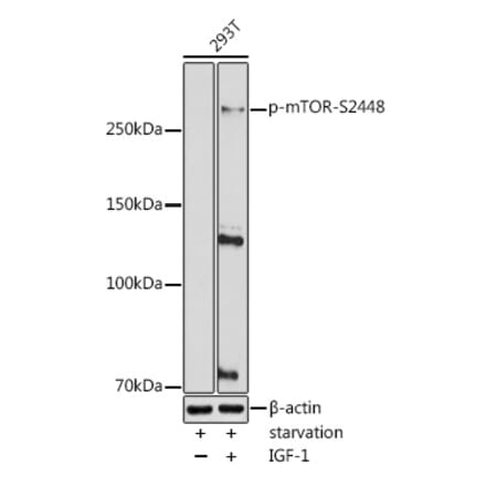 Western Blot - Anti-mTOR (phospho Ser2448) Antibody (A10887) - Antibodies.com