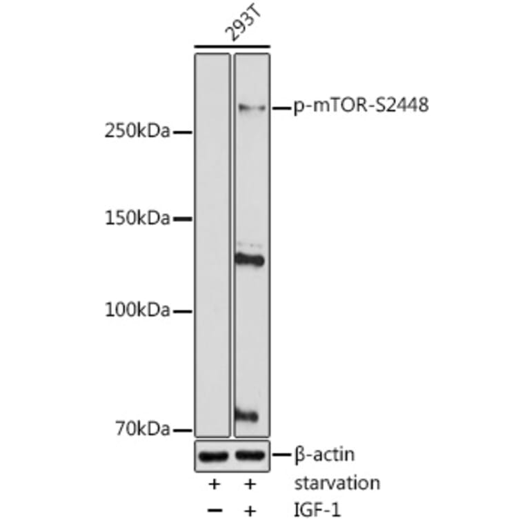 Western Blot - Anti-mTOR (phospho Ser2448) Antibody (A10887) - Antibodies.com