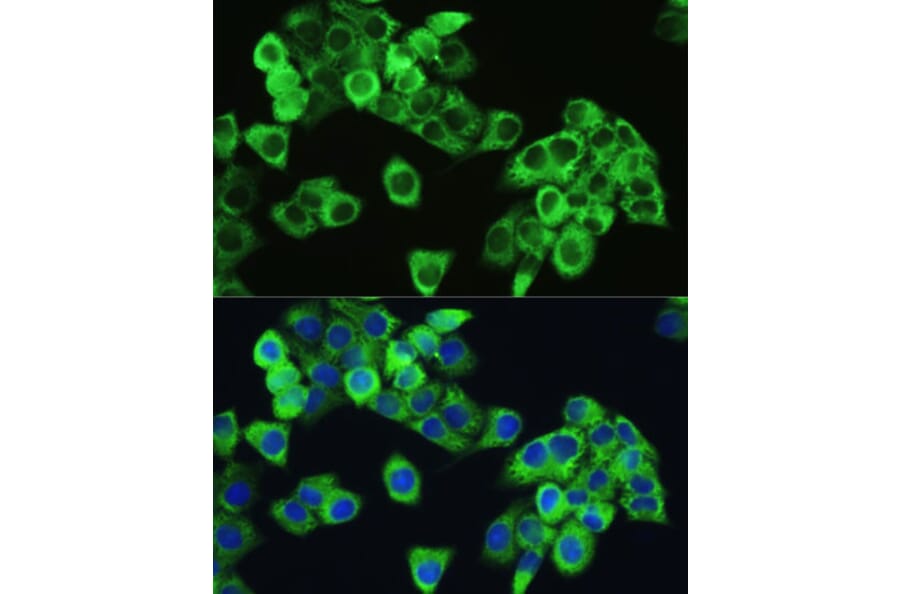 Immunofluorescence - Anti-mTOR (phospho Ser2448) Antibody (A10887) - Antibodies.com