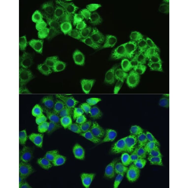 Immunofluorescence - Anti-mTOR (phospho Ser2448) Antibody (A10887) - Antibodies.com