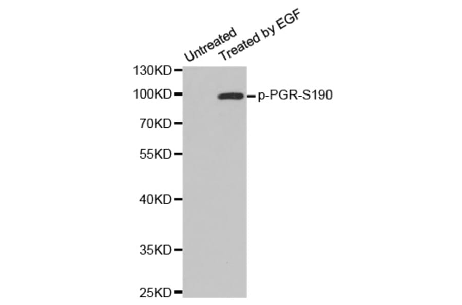 Western Blot - Anti-PGR (phospho S190) Antibody (AP0147) - Antibodies.com