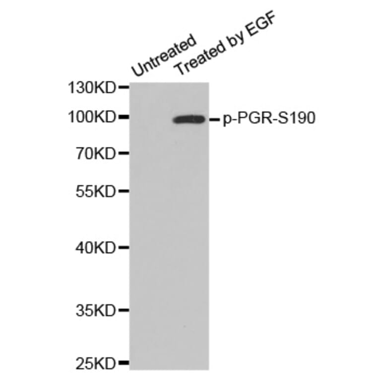 Western Blot - Anti-PGR (phospho S190) Antibody (AP0147) - Antibodies.com
