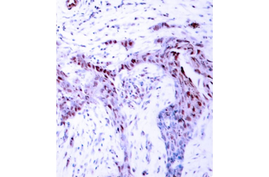 Immunohistochemistry - Anti-PGR (phospho S190) Antibody (AP0147) - Antibodies.com
