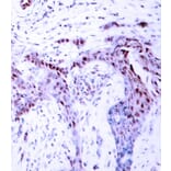 Immunohistochemistry - Anti-PGR (phospho S190) Antibody (AP0147) - Antibodies.com