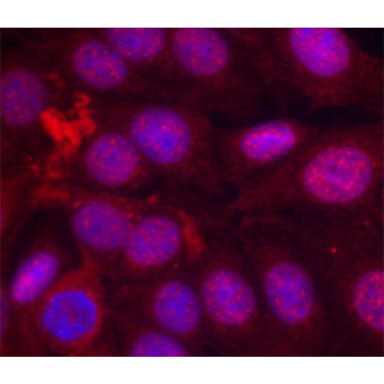 Immunofluorescence - Anti-PGR (phospho S190) Antibody (AP0147) - Antibodies.com