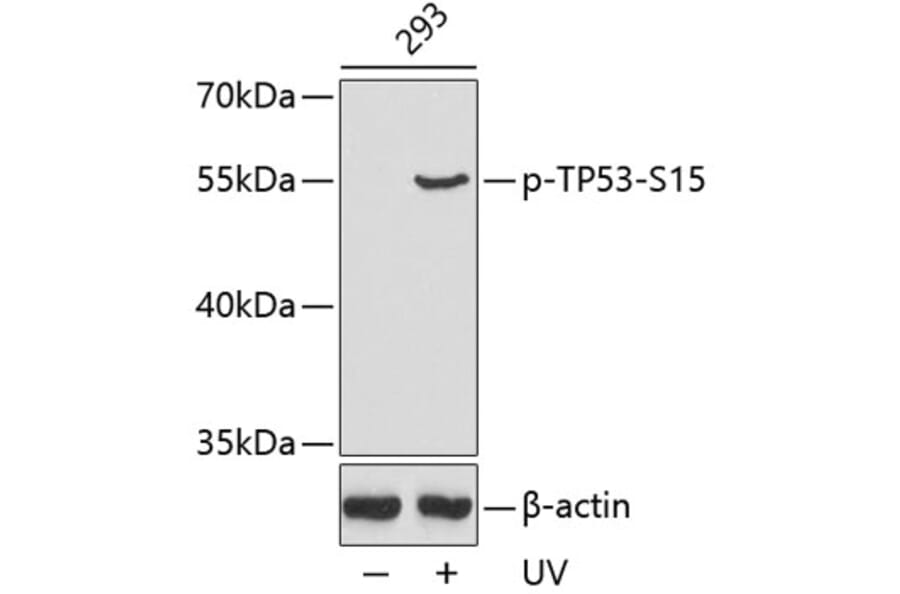 Western Blot - Anti-TP53 (phospho S15) Antibody (AP0158) - Antibodies.com
