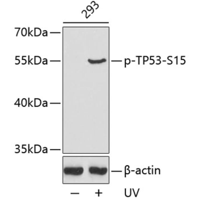 Western Blot - Anti-TP53 (phospho S15) Antibody (AP0158) - Antibodies.com