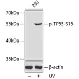 Western Blot - Anti-TP53 (phospho S15) Antibody (AP0158) - Antibodies.com