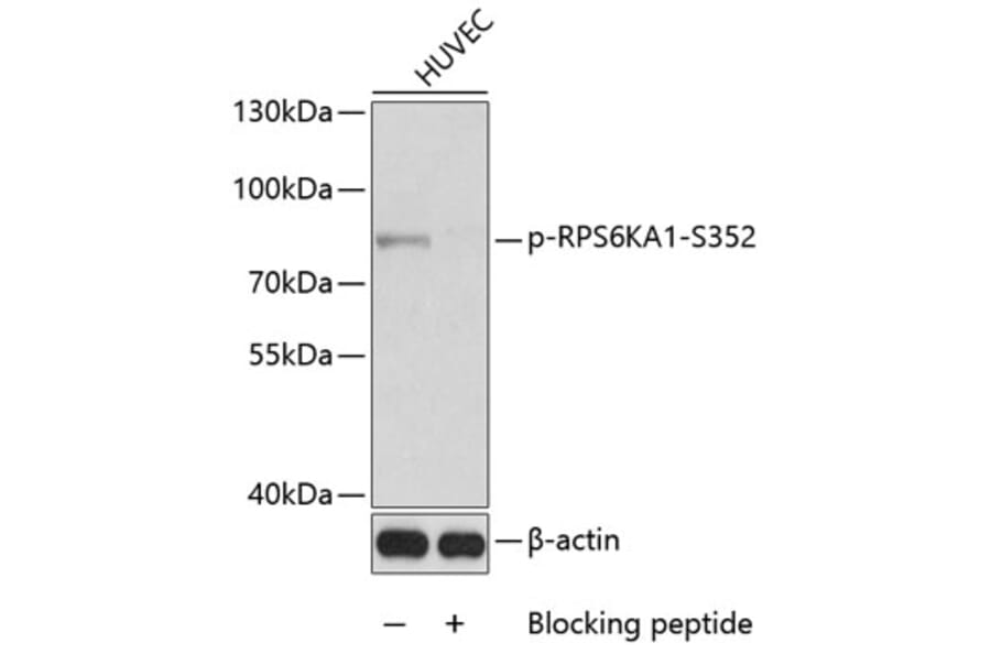 Western Blot - Anti-P90RSK (phospho S352) Antibody (AP0171) - Antibodies.com