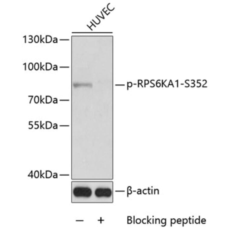 Western Blot - Anti-P90RSK (phospho S352) Antibody (AP0171) - Antibodies.com