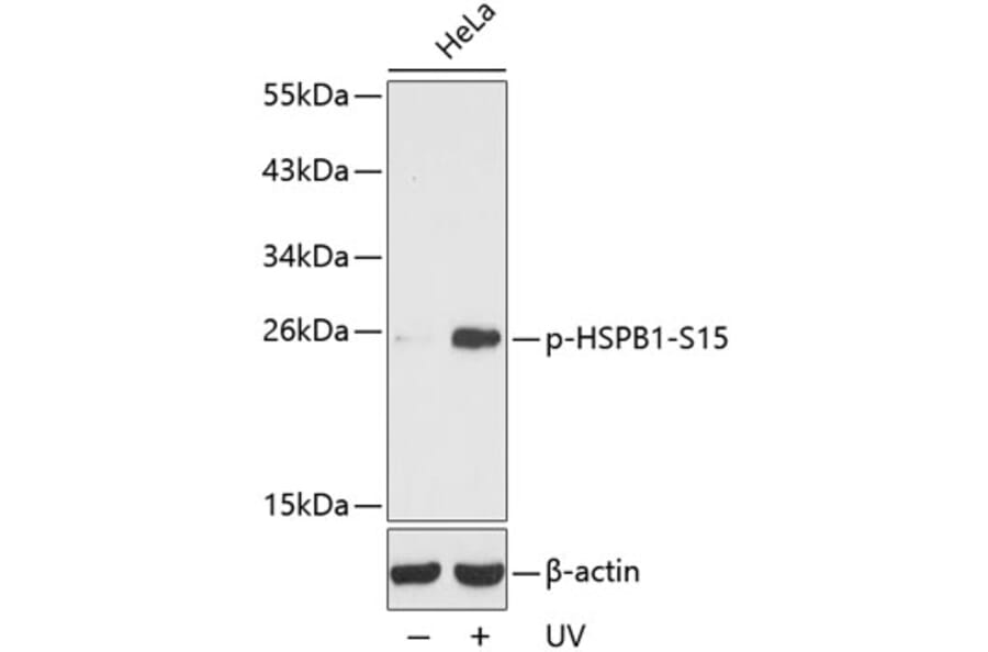 Western Blot - Anti-HSPB1 (phospho S15) Antibody (AP0189) - Antibodies.com