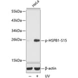 Western Blot - Anti-HSPB1 (phospho S15) Antibody (AP0189) - Antibodies.com