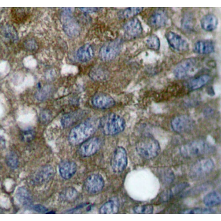 Immunohistochemistry - Anti-HSPB1 (phospho S15) Antibody (AP0189) - Antibodies.com