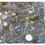 Immunohistochemistry - Anti-HSPB1 (phospho S15) Antibody (AP0189) - Antibodies.com
