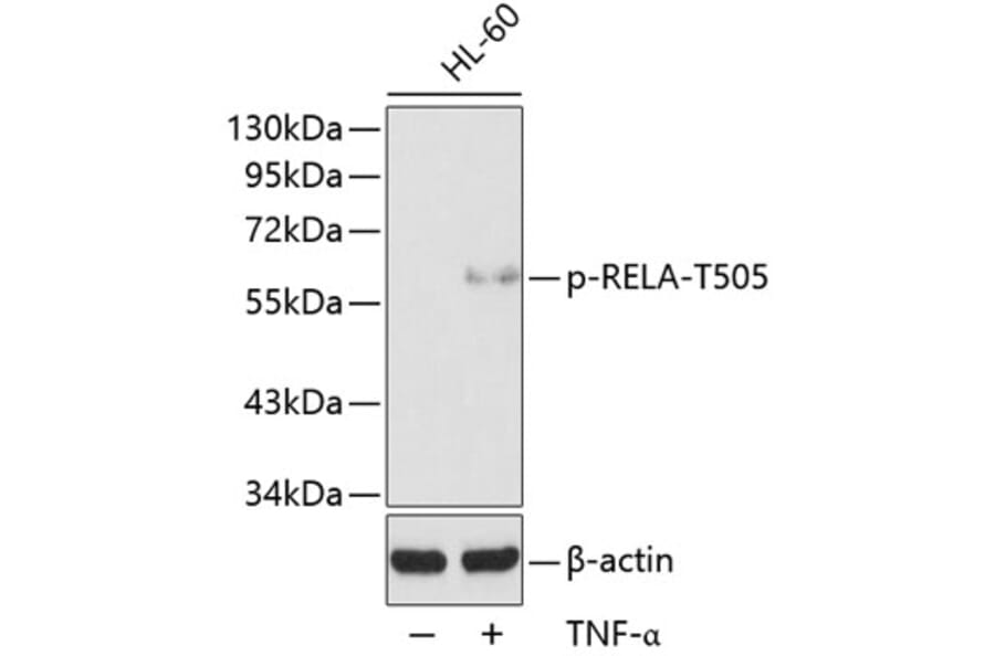 Western Blot - Anti-RELA (phospho T505) Antibody (AP0190) - Antibodies.com