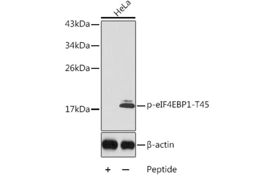 Western Blot - Anti-eIF4EBP1 (phospho Thr45) Antibody (A10899) - Antibodies.com