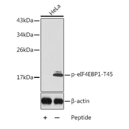 Western Blot - Anti-eIF4EBP1 (phospho Thr45) Antibody (A10899) - Antibodies.com